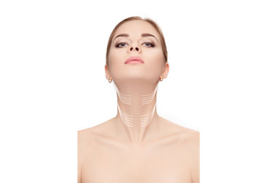 Neck Lift